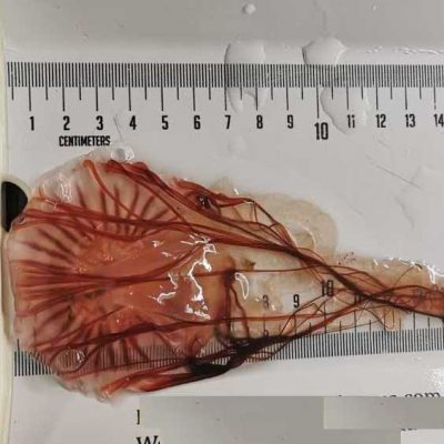 Shedding light on mysterious jellyfish diets